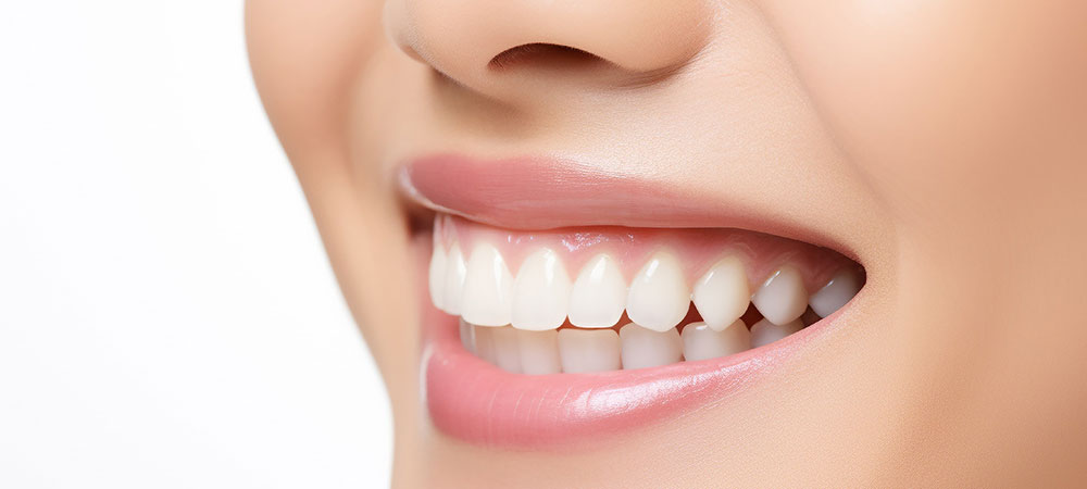 歯にメリットの多い矯正歯科治療