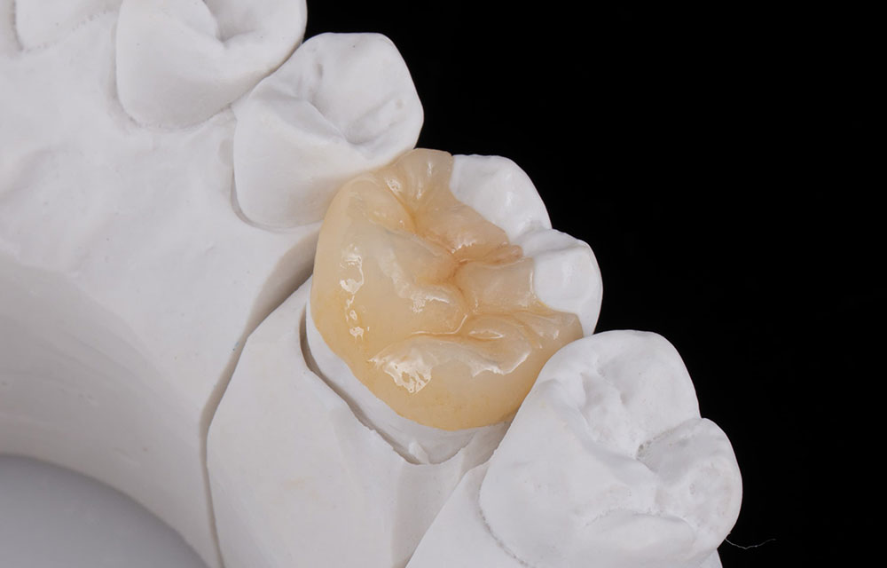 ハイブリッドセラミック