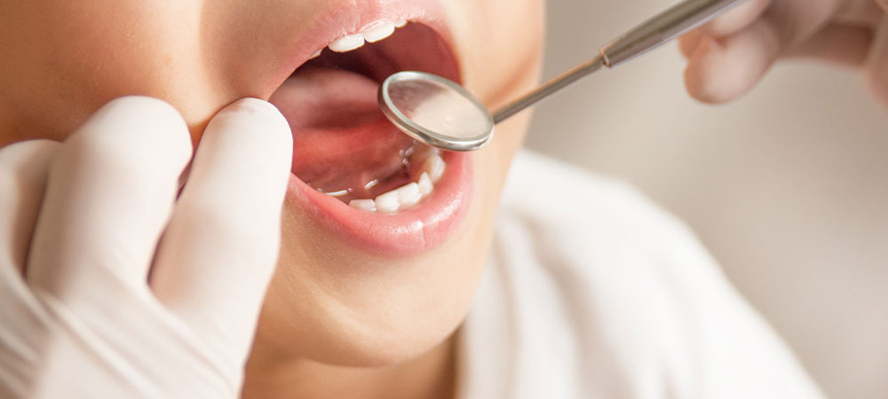 お子さまのお口の健康を守る小児歯科