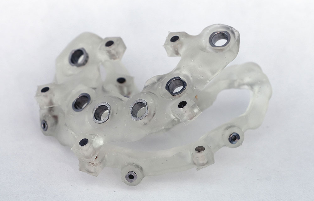 サージカルガイドによる正確な埋入