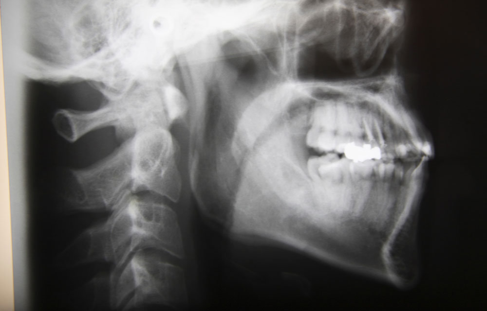 診断・治療計画作成