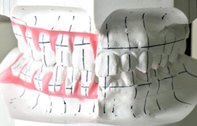 診断・治療計画作成