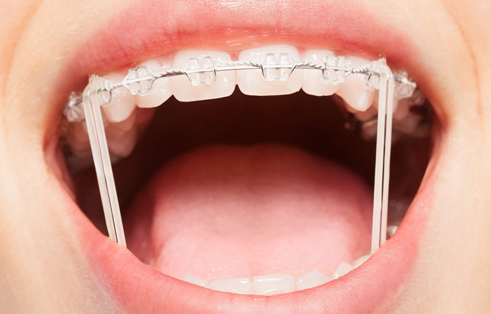 装置の調整・経過観察