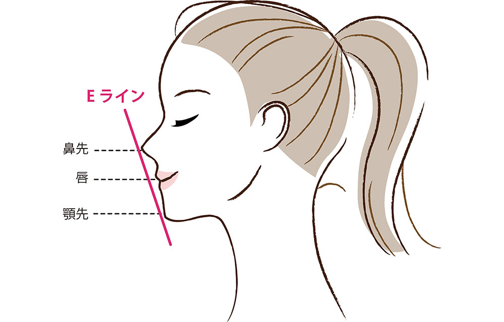 Nasolabial angle（口唇側貌：こうしんそくぼう）とE-line